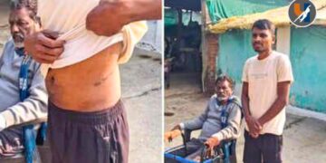 संतापजनक! कर्जाच्या विळख्यात बळीराजाचा ‘बळी’; १ लाखासाठी विकली स्वतःची किडनी